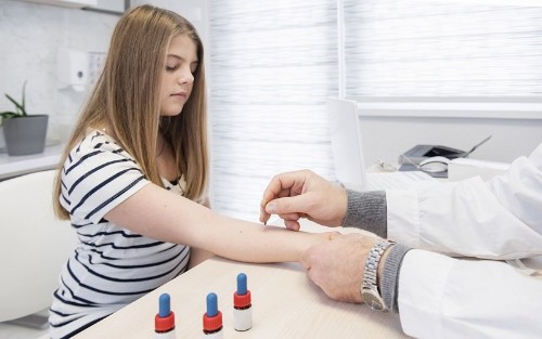 Pruebas de alergia al látex