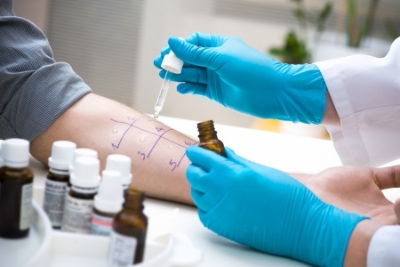 Pruebas para la alergia